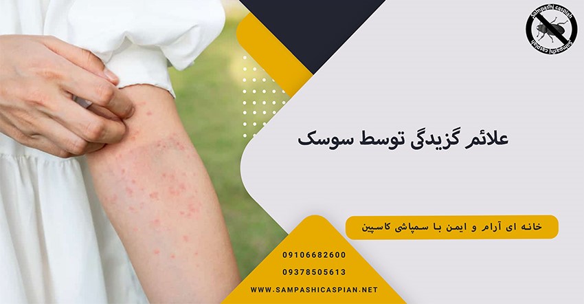 علائم گزیدگی توسط سوسک فاضلاب